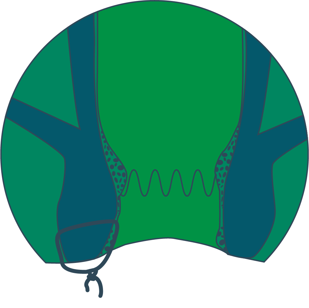 Fistulotomy and Seton Insertion