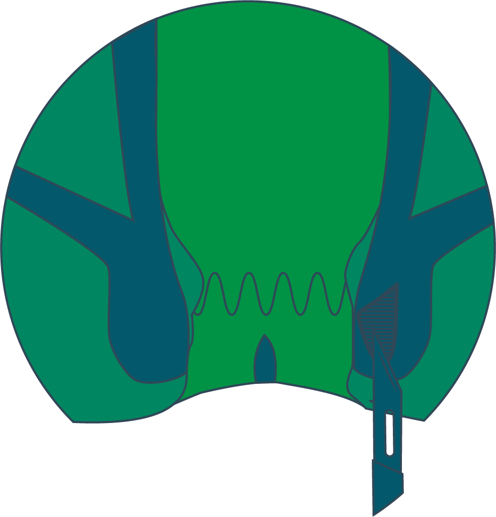 Sphincterotomy